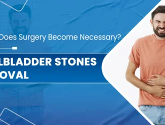 Gallbladder Stones Removal