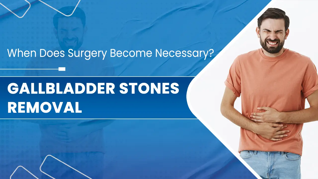 Gallbladder Stones Removal