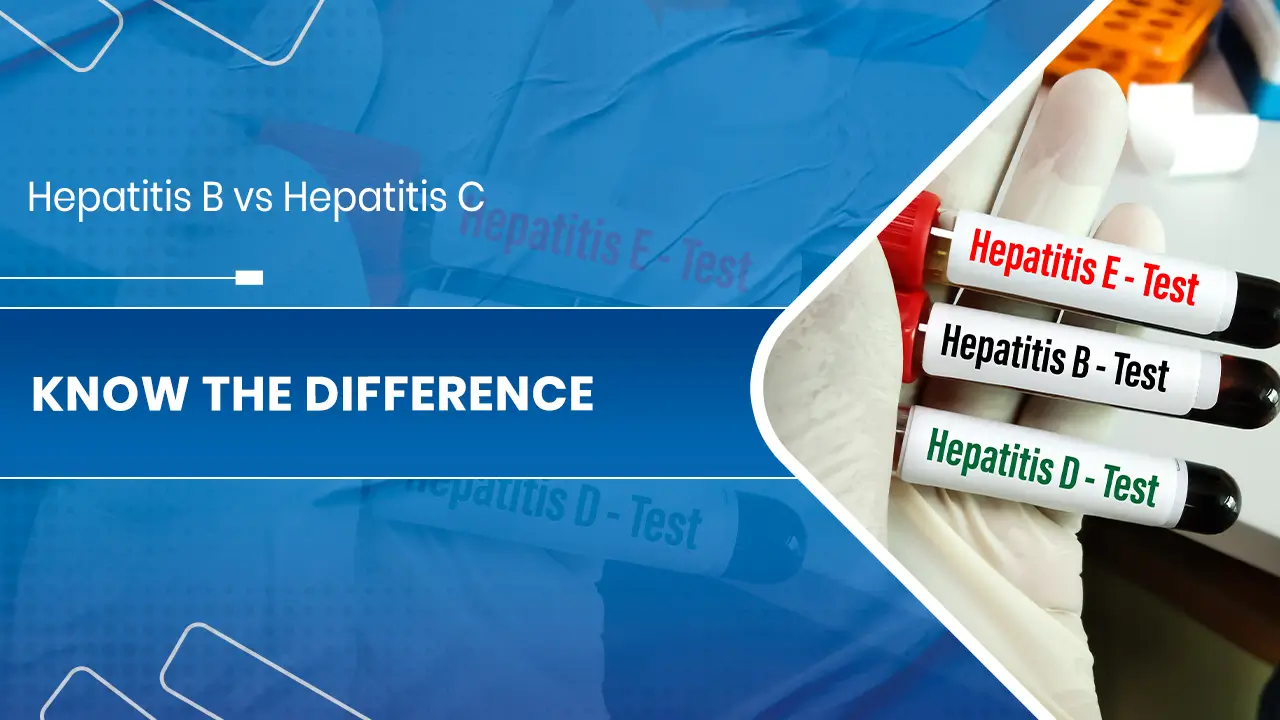 Hepatitis B vs Hepatitis C.jpg