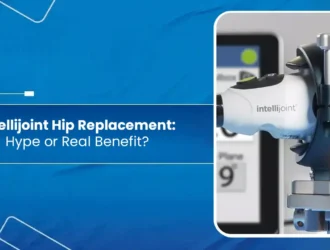 Intellijoint Hip Replacement