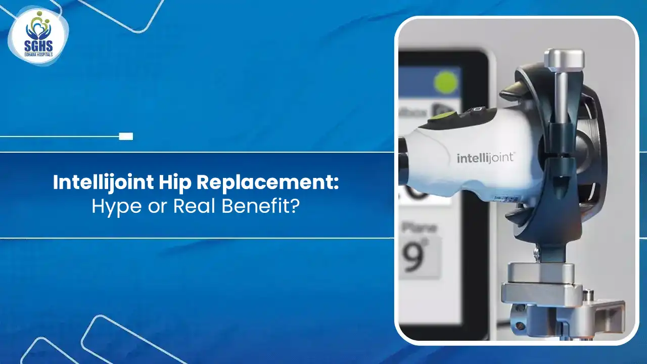 Intellijoint Hip Replacement