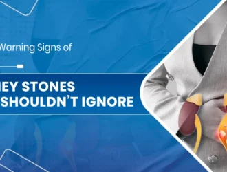 Kidney Stones You Shouldn’t Ignore