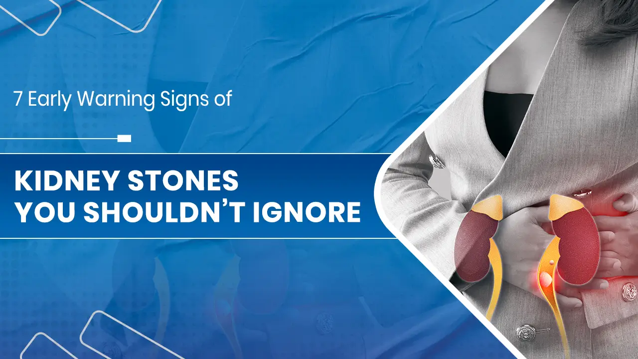 Kidney Stones You Shouldn’t Ignore