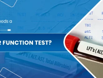 Liver Function Test