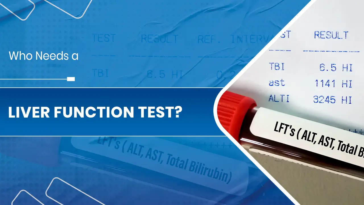 Liver Function Test