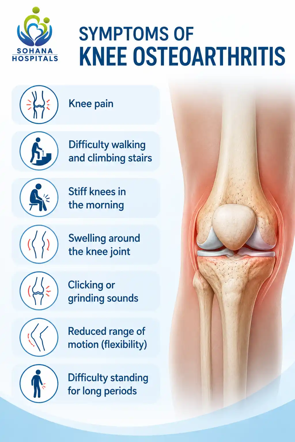 Symptoms of Knee Osteoarthritis