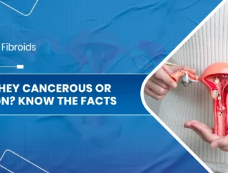 Uterine Fibroids