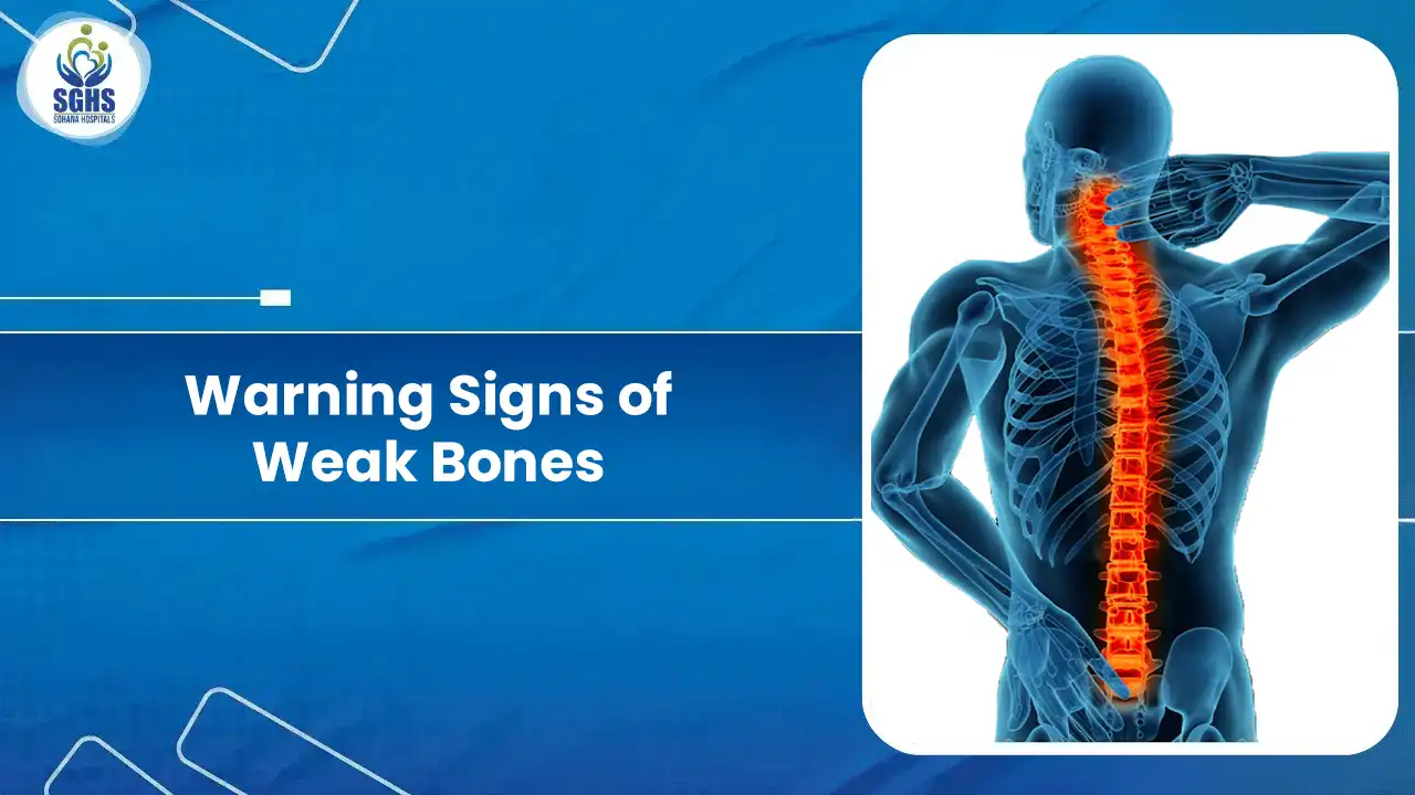 Warning Signs of Weak Bones