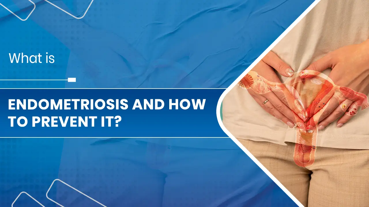 What is Endometriosis