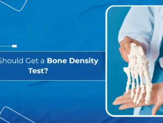 Who Should Get a Bone Density Test
