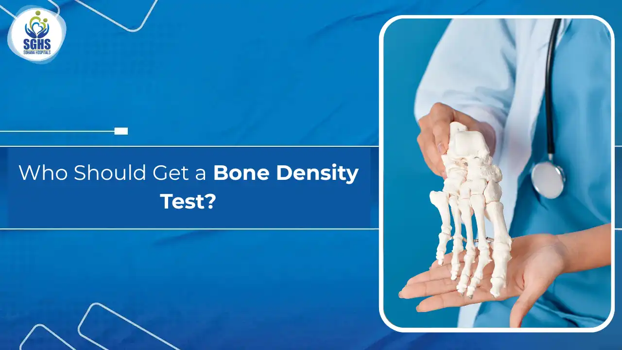 Who Should Get a Bone Density Test
