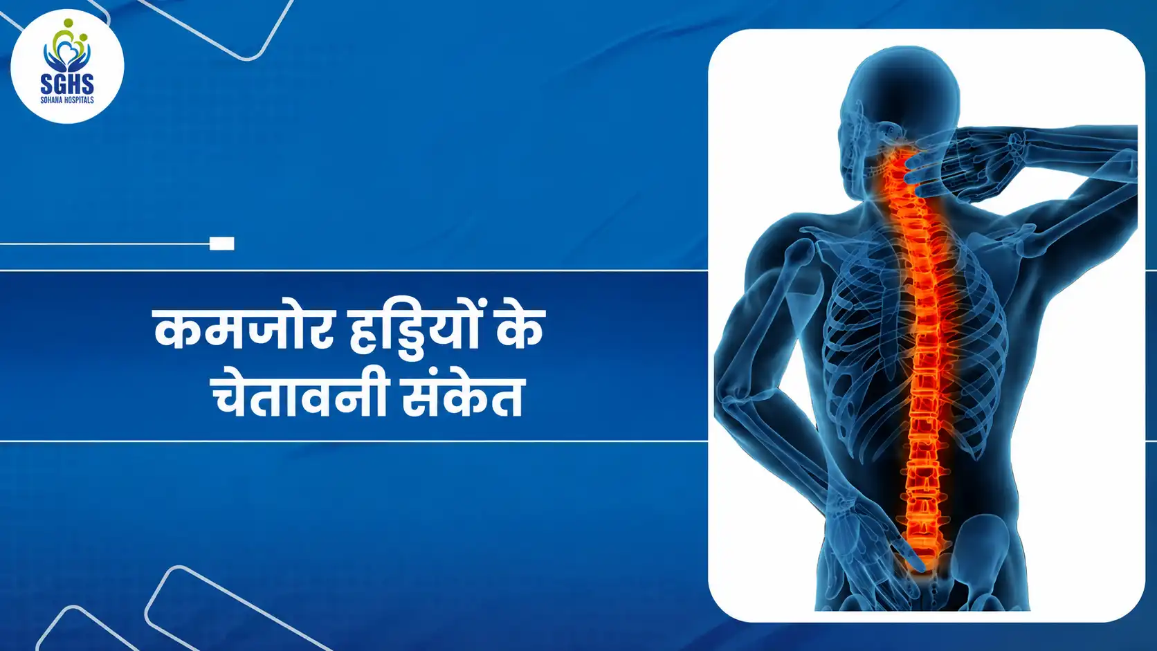 कमजोर हड्डियों के चेतावनी संकेत