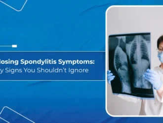Ankylosing Spondylitis Symptoms: Early Signs You Shouldn’t Ignore