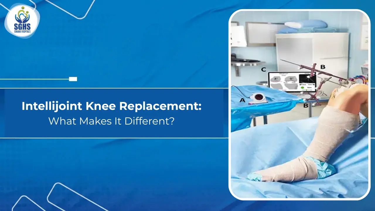 Intellijoint Knee Replacement