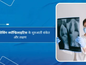 एंकायलोसिंग स्पॉन्डिलाइटिस के शुरुआती संकेत और लक्षण