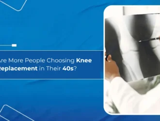 Why Are More People Choosing Knee Replacement in Their 40s