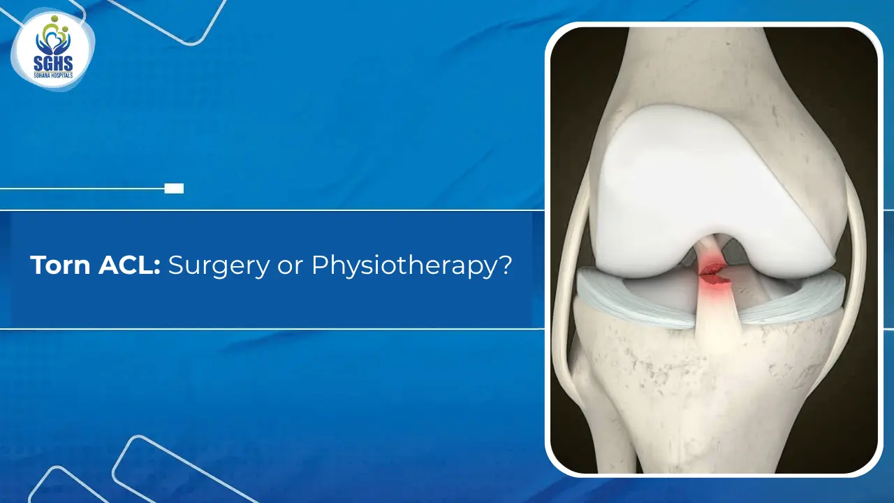 Torn ACL - Surgery or Physiotherapy